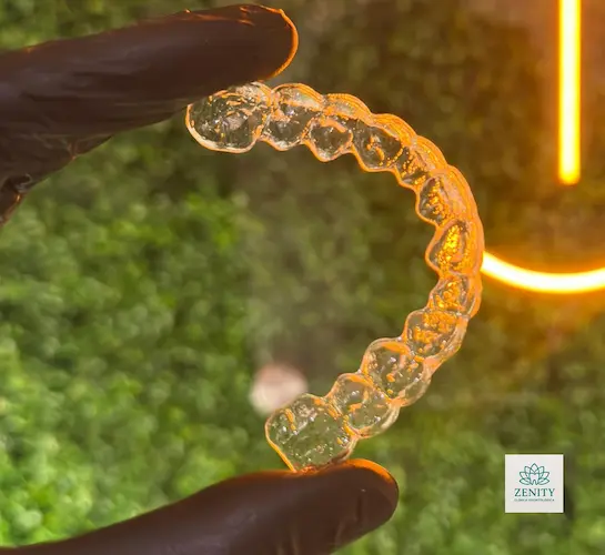 Alinhadores invisíveis - Zenity Odontologia