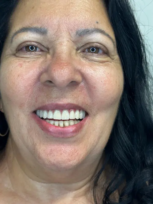 Dr. Jefferson Silva - CROSP 135609 realizando Implante Protocolo na Zenity Odontologia Estética